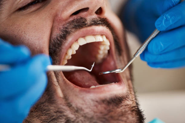 Dental X-Rays and Imaging in Somerset, OH